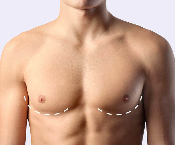  ⁠ثدي الرجال